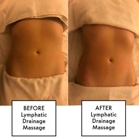 Two-panel photo of a midsection before and after lymphatic drainage massage, with 'BEFORE' and 'AFTER' labels on each panel.